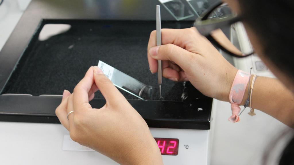 Servicio de Anatomía Patológica de la Fundación Jiménez Díaz.