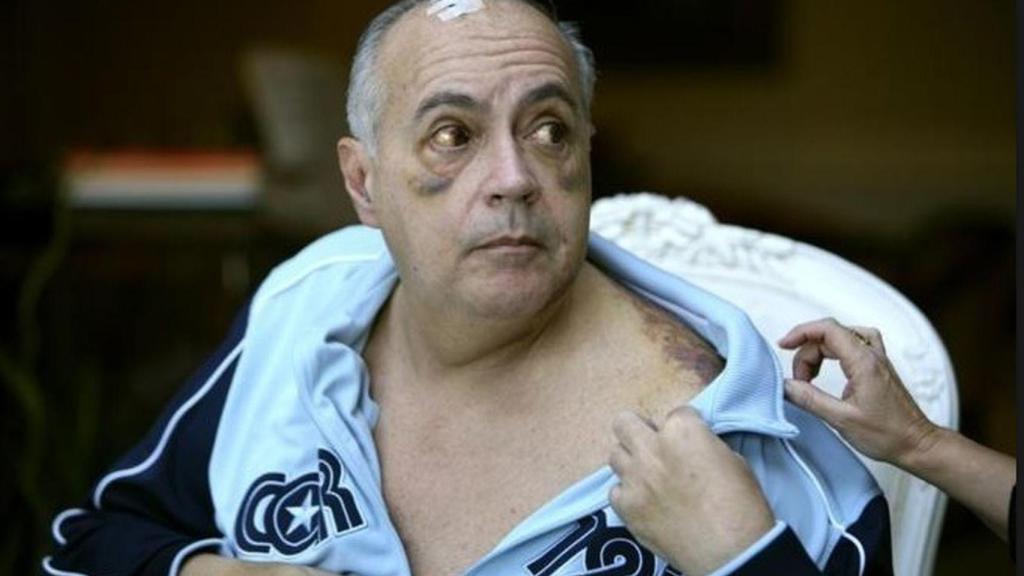 José Luis Moreno en el atraco que sufrió en 2009.