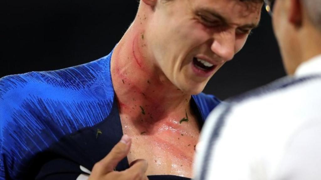 Pavard, tras el pisotón en el cuello.