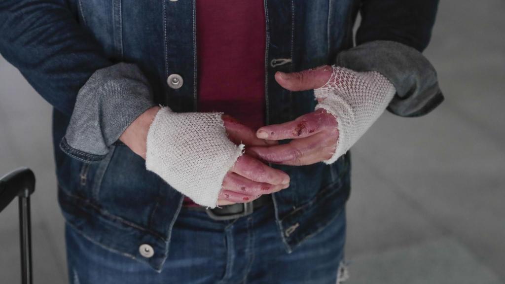 Los vendajes que cubren las manos de Tenorio.