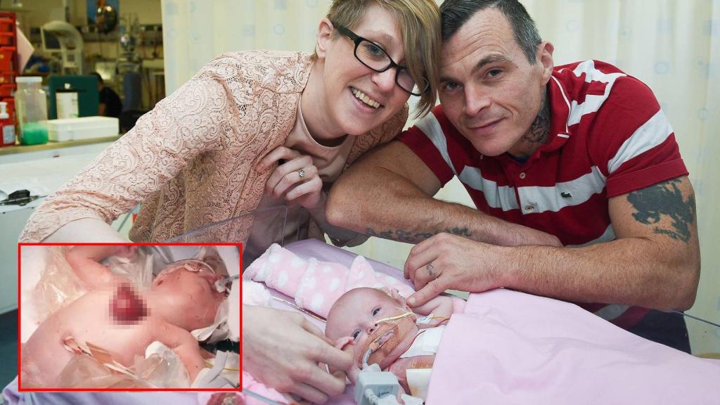 Vanellope, antes de la operación y junto a sus padres al recibir el alta.