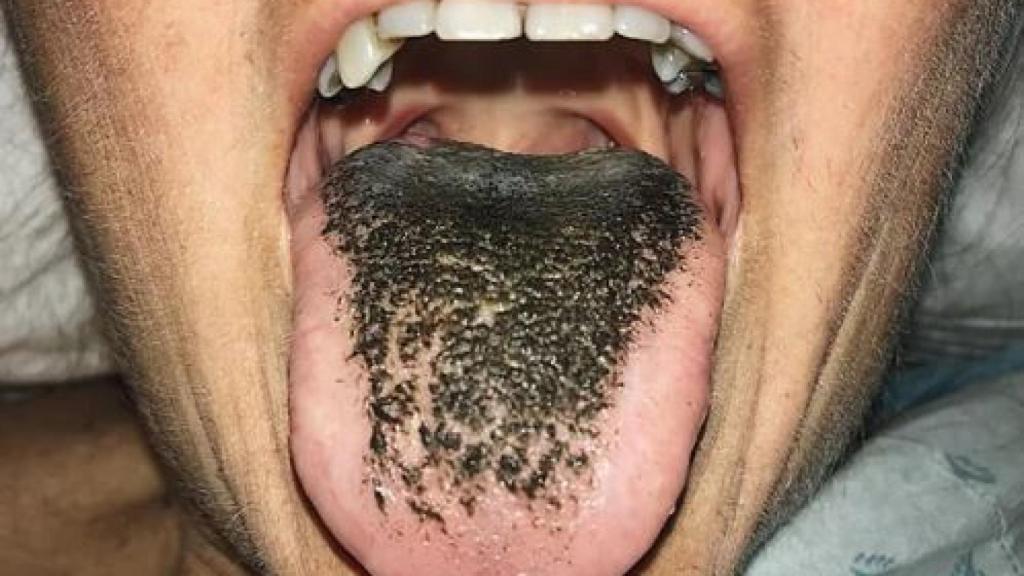 La mujer afectada por el extraño efecto secundario.