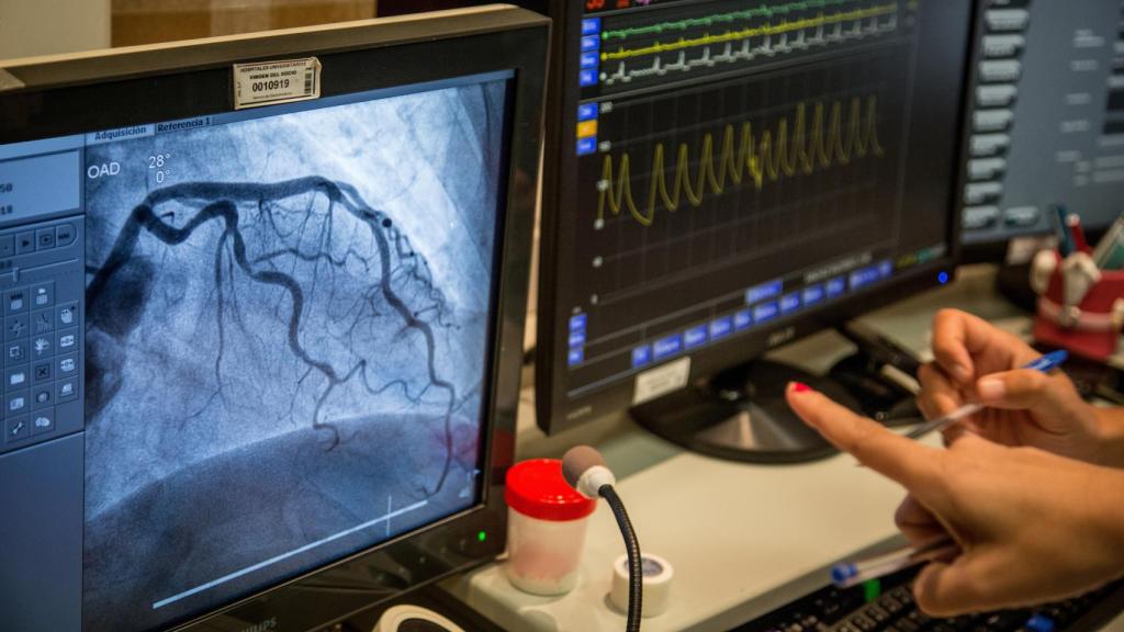 El equipo médico controlando los monitores durante un cateterismo. Foto Fernando Ruso
