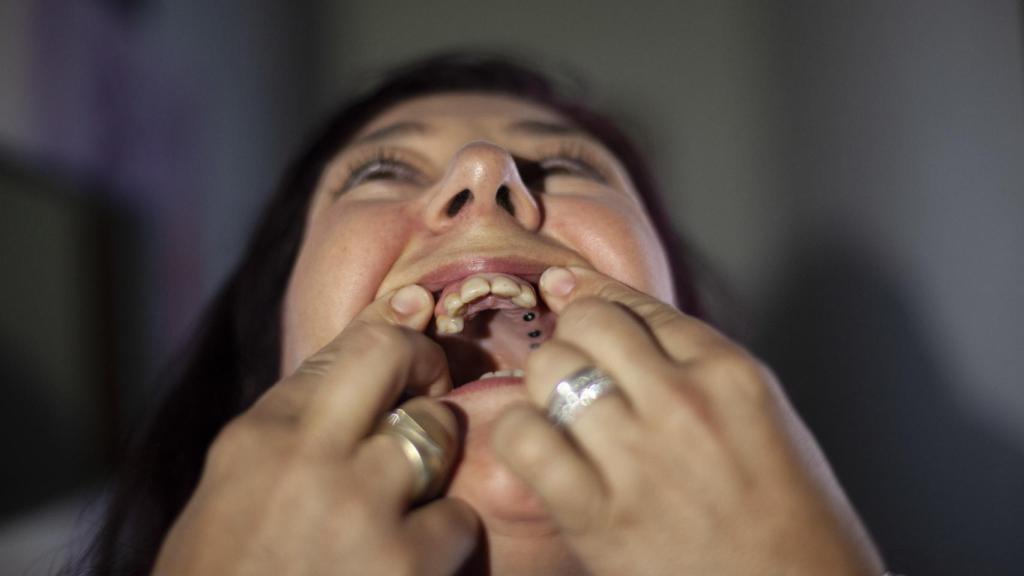 Emilia enseña cómo le ha dejado la boca iDental.