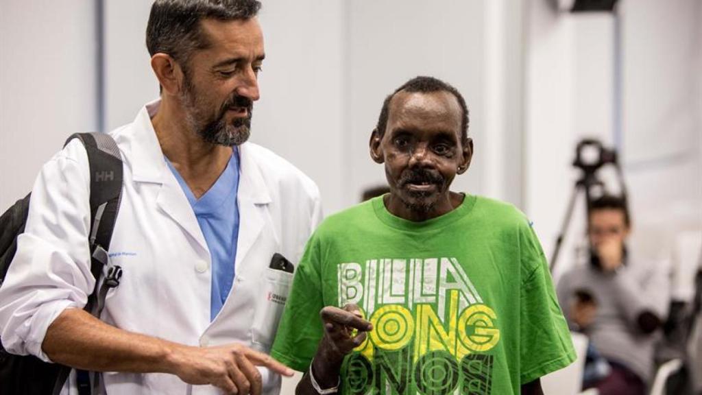El doctor Cavadas presenta el rostro y la mano reconstruidos de Lonunuko, atacado por una hiena.