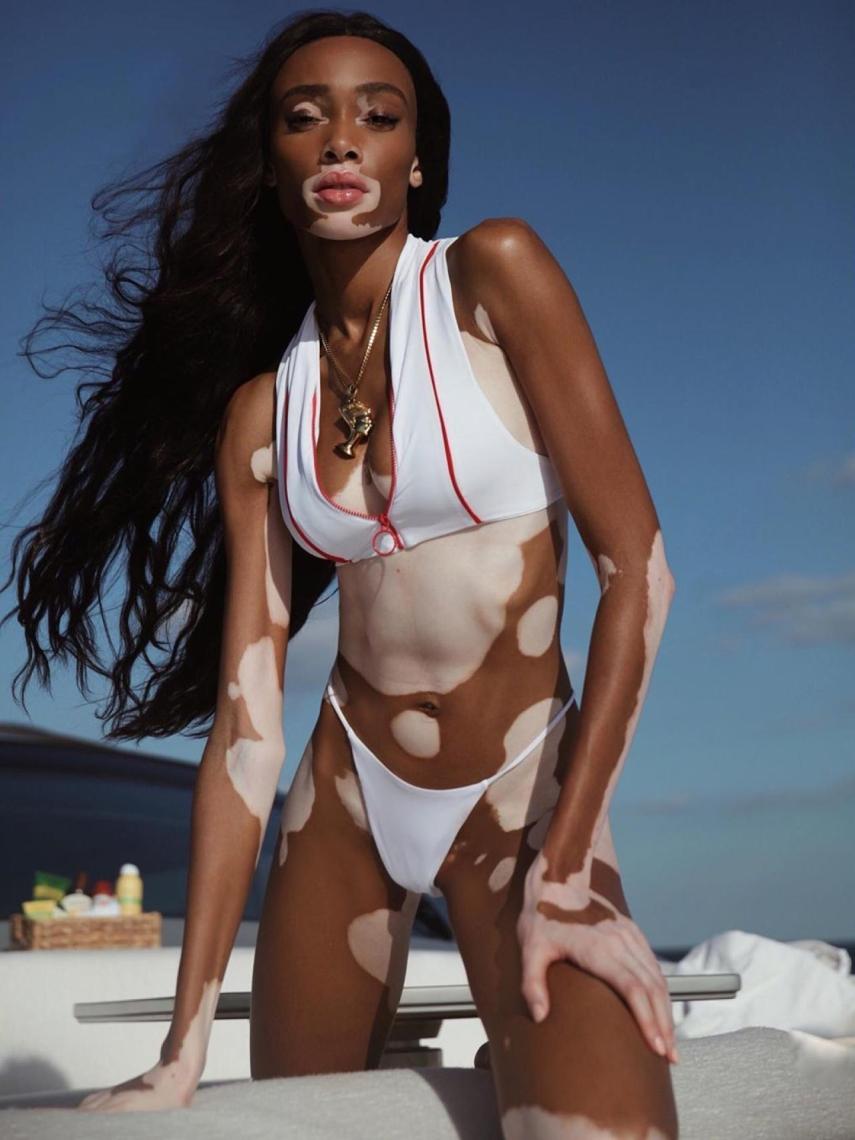 La modelo Winnie Harlow.