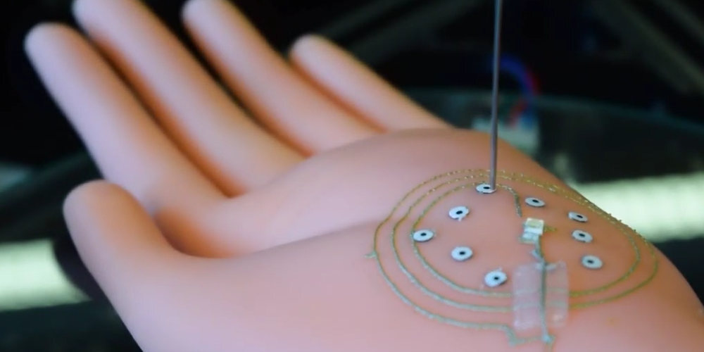 protesis impresion 3d