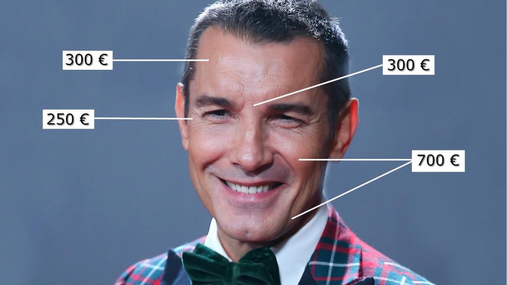 Jesús Vázquez y el precio de sus retoques estéticos