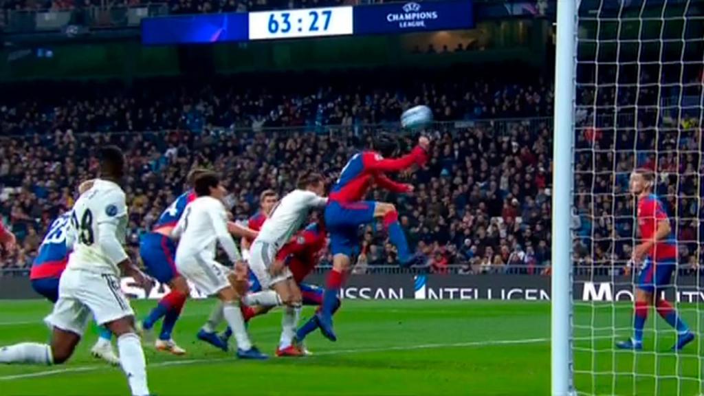 Gareth Bale se lesiona frente al CSKA de Moscú