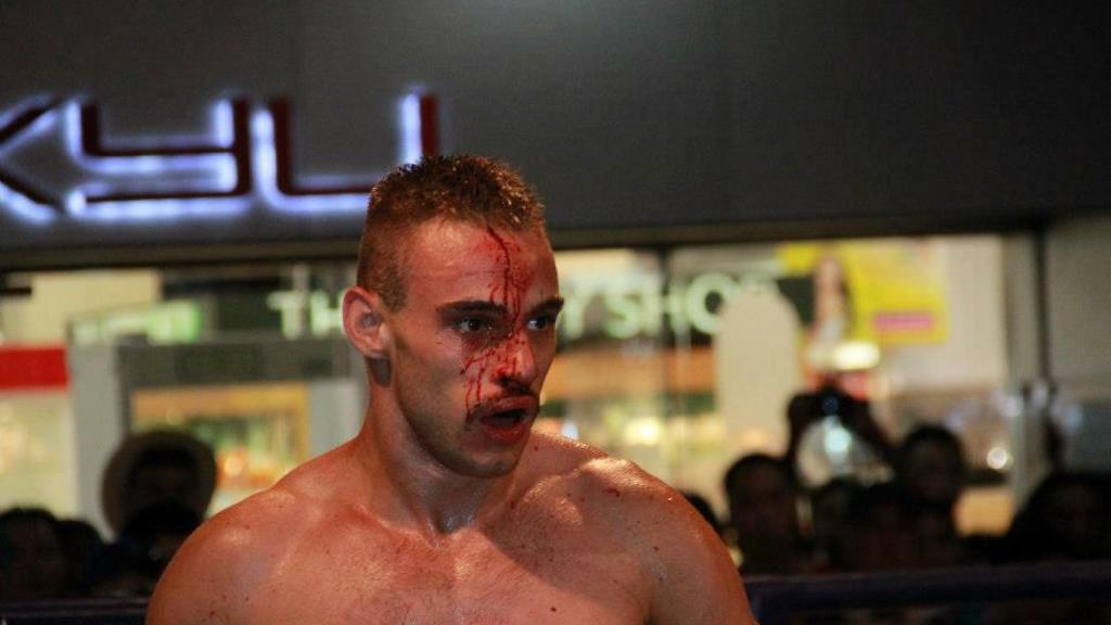 'El nene', ensangrentado, en una de sus peleas recientes de muay thai.