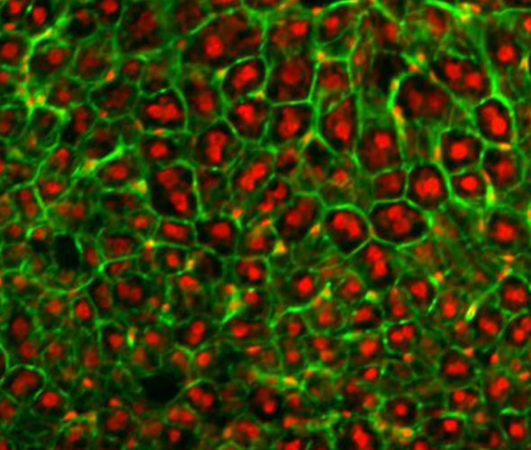 tumor realidad virtual 2