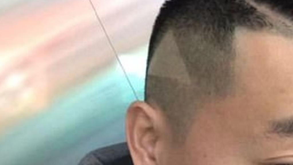 El extraño triángulo en la cabeza del hombre