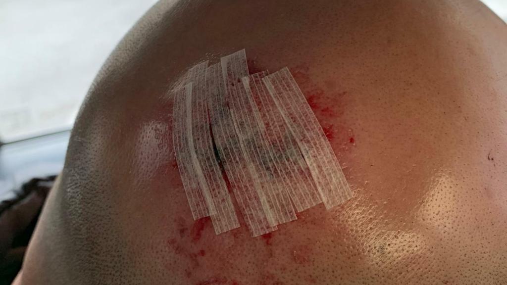 Agresión a un taxista en Barcelona.