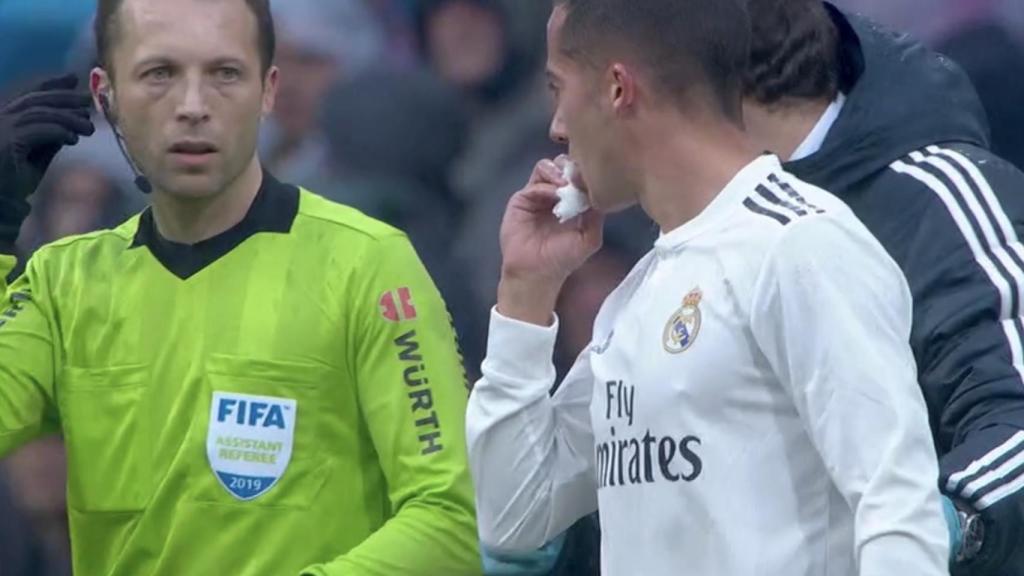Lucas Vázquez, sangrando tras un golpe de Sergi Gómez