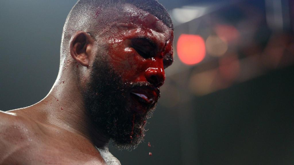 El sangriento combate entre Badou Jack y Marcus Browne