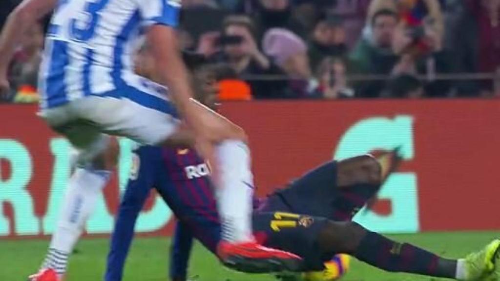 Dembele y su lesión de tobillo. Foto: Twitter. (@elchiringuitotv)