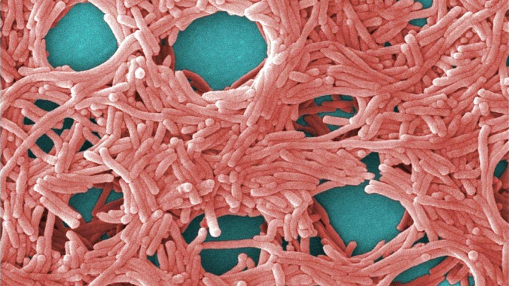 La legionela vista a través del microoscopio.