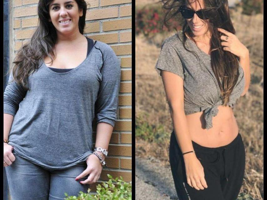 Anabel Pantoja antes y después de su operación de banda gástrica.