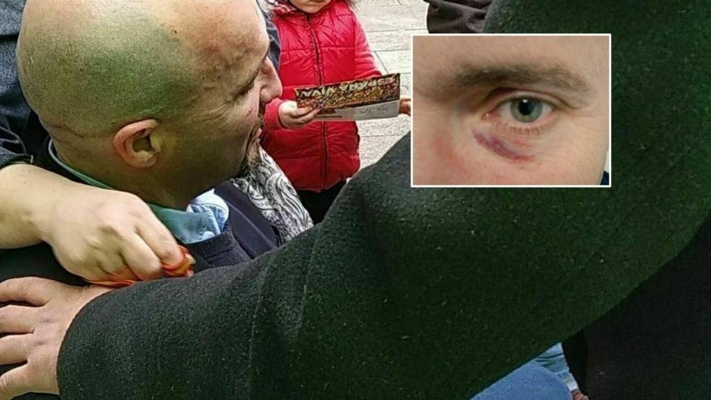 Juan Manuel, guardia civil retirado, fue agredido por el mismo chaval que atacó a Rajoy.