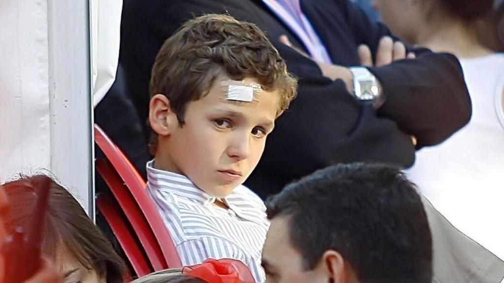 Froilán con una herida en la frente.