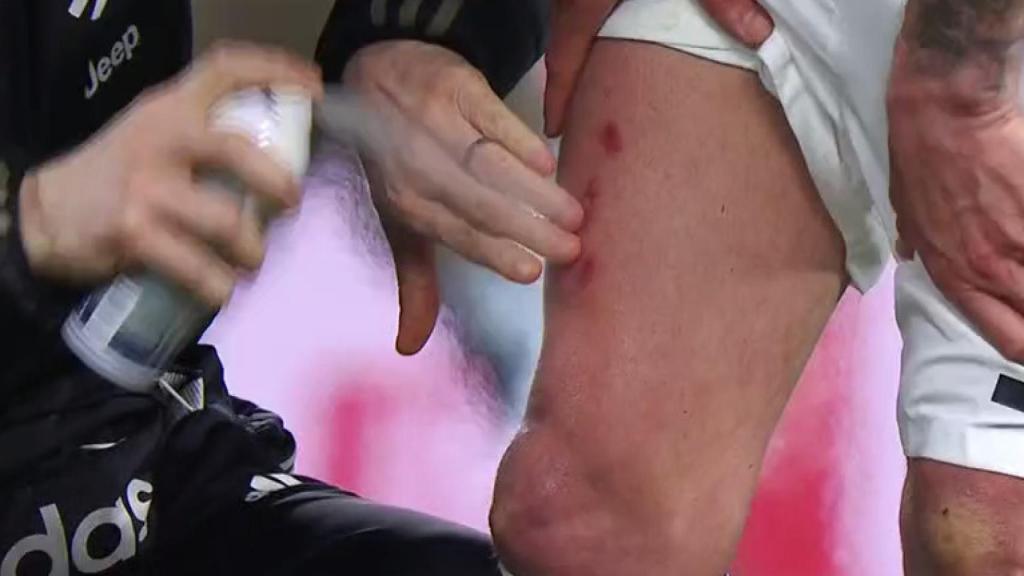 Mandzukic se queja de una fea entrada del Atlético de Madrid. Foto: Twitter. (@elchiringuitotv)