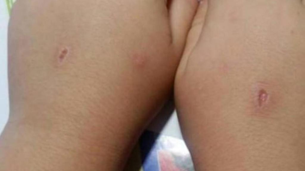 El tipo de heridas que deja el reto del 'Abecedario del diablo'.