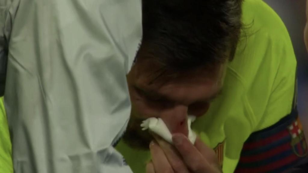Messi recibe un duro golpe en la nariz
