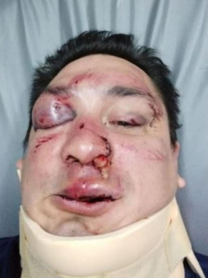 Sebastian Acosta, agredido por los barrabravas