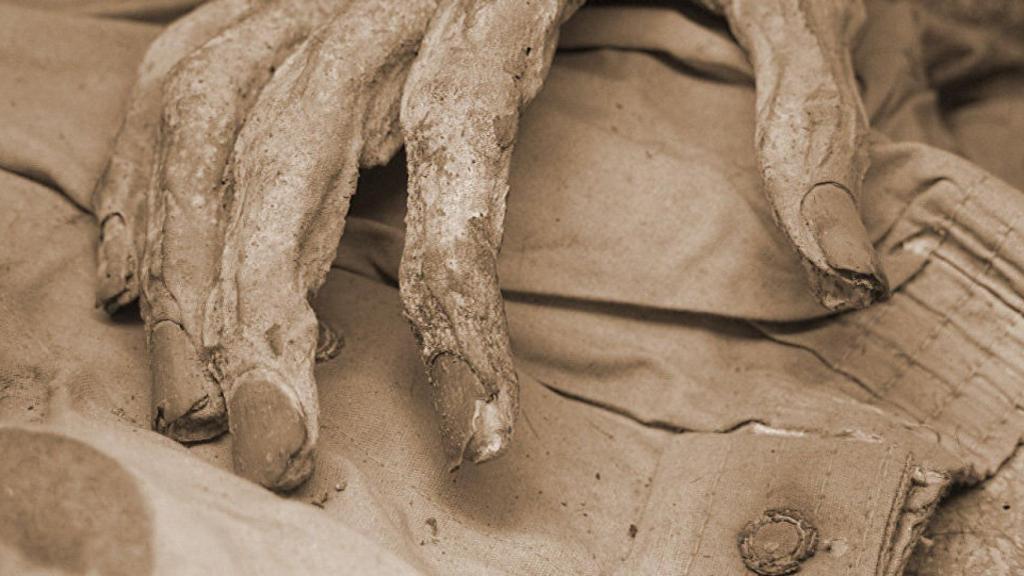 Cadáver momificado.