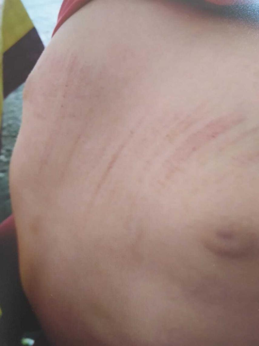 El menor ha sufrido distintas agresiones por todo el cuerpo, en dos ocasiones.