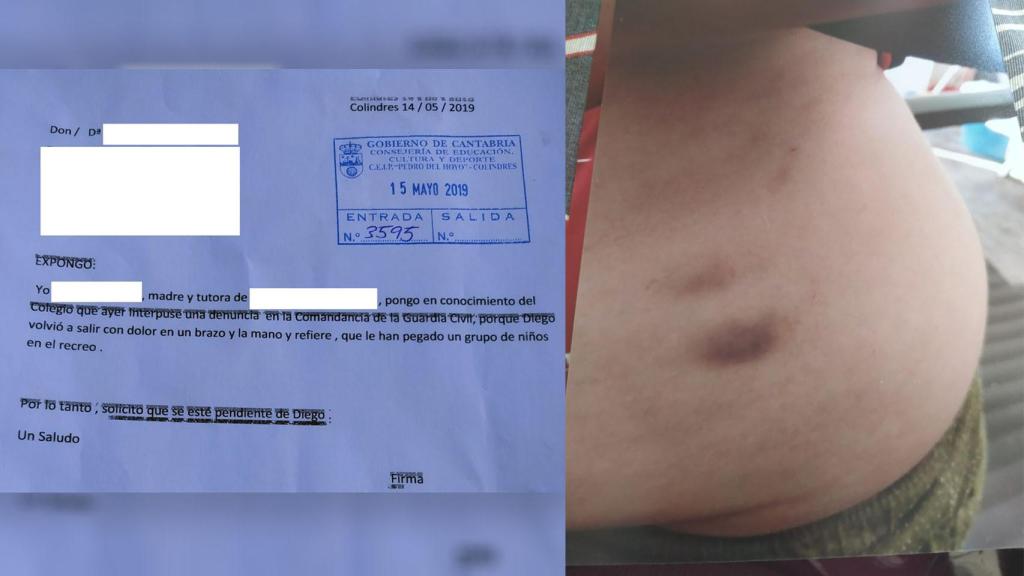 Los hechos han ocurrido en un colegio de Colindres (Cantabria). Foto cedida por la Asociación Tolerancia 0 al Bullying.