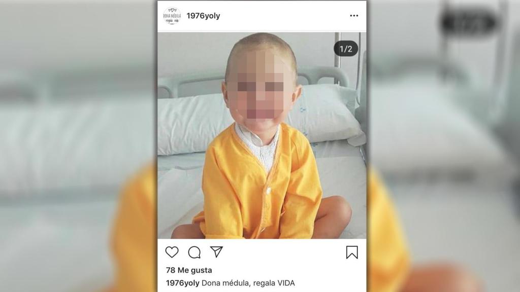 Rafa murió en Oviedo a los 4 años después de pasar la mitad de su vida luchando contra el cáncer.