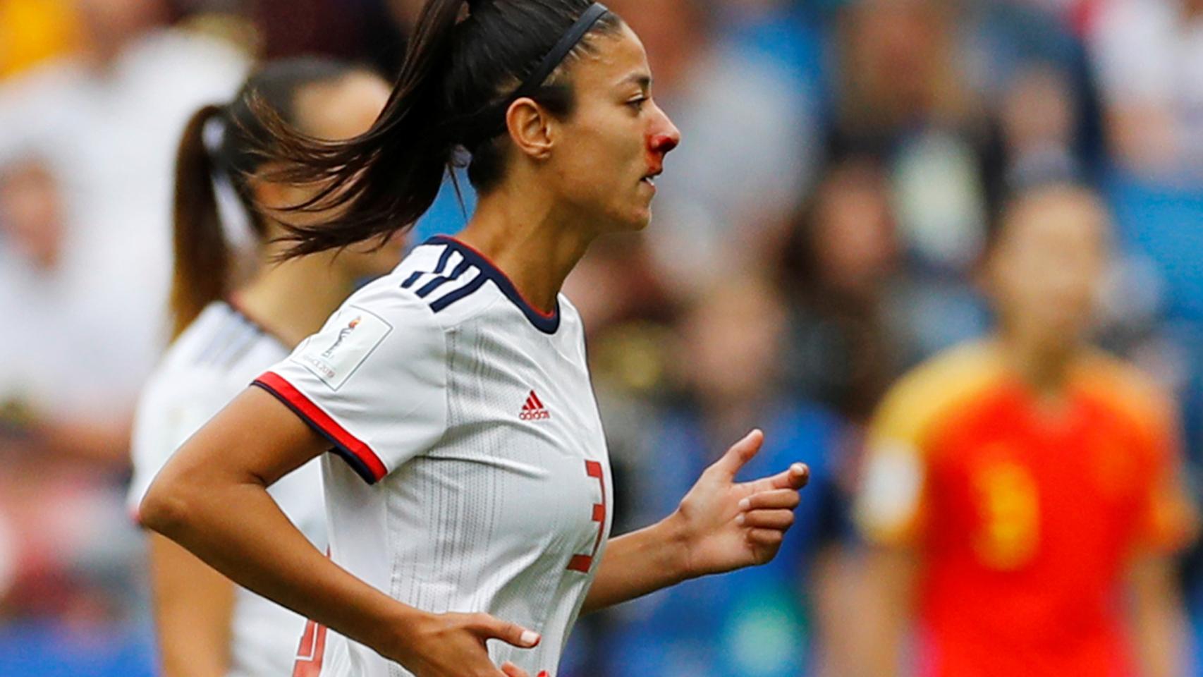 Leila Ouahabi sangra por la nariz tras un golpe