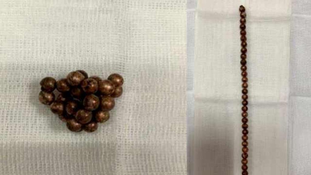 Las bolas retiradas del pene del adolescente.