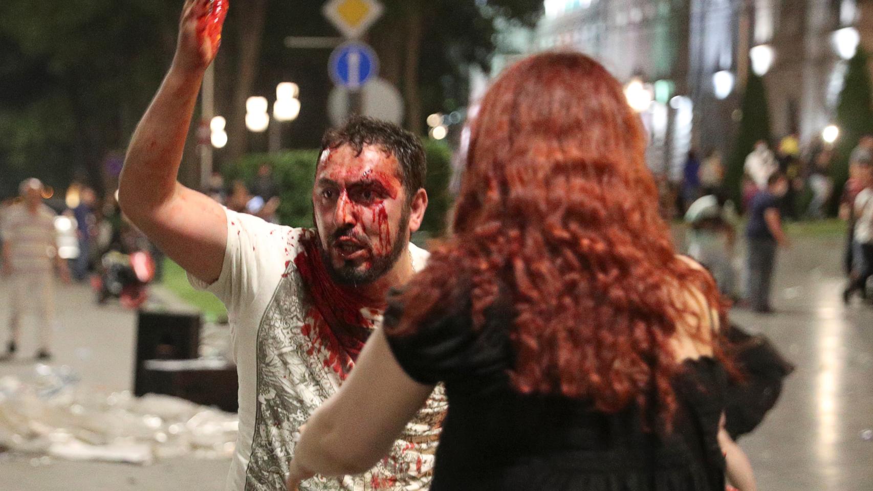 Lo disturbios en Georgia, en imágenes