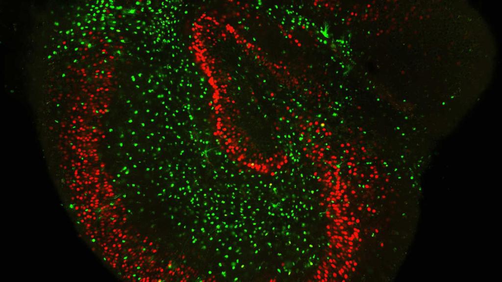El cerebro de una rata con los dos tipos de células marcadas