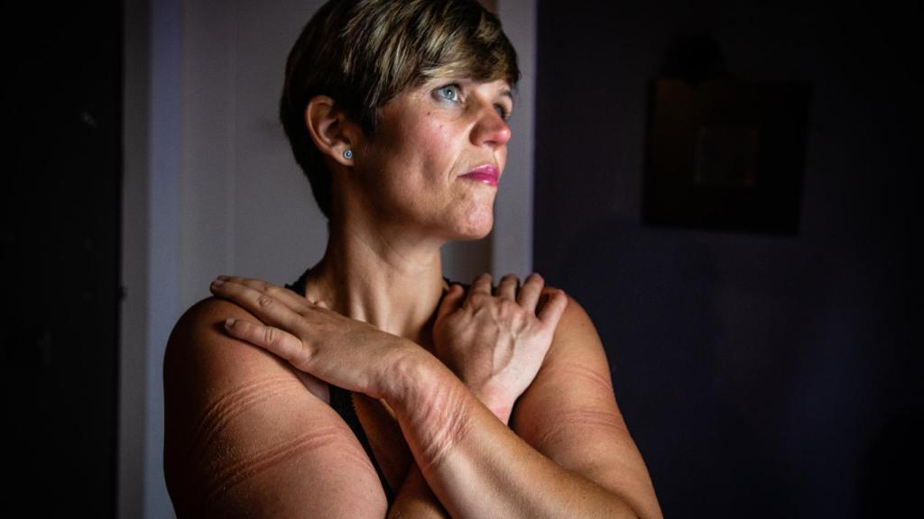 Señales de las cuerdas tras la sesión de shibari.