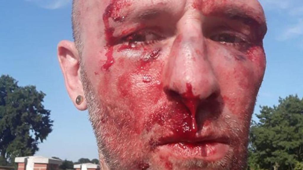 Periodista agredido por criticar una pintada homófoba.