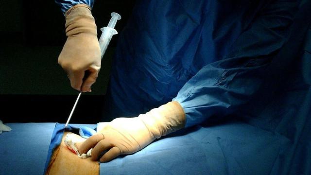 Hacerse donante de médula es algo que puede salvar vidas