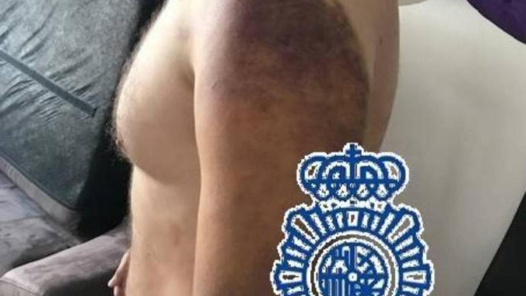 Foto: Policía Nacional