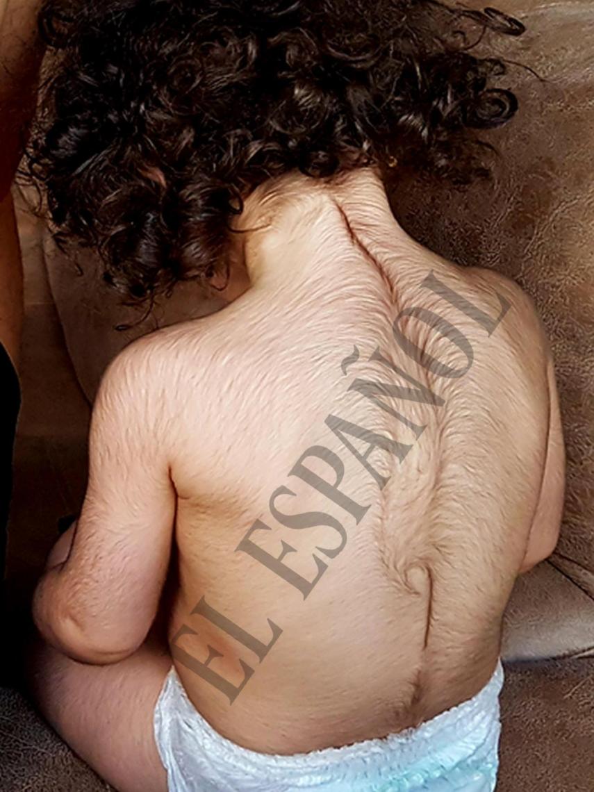 La pequeña Maite (nombre ficticio), de espaldas.