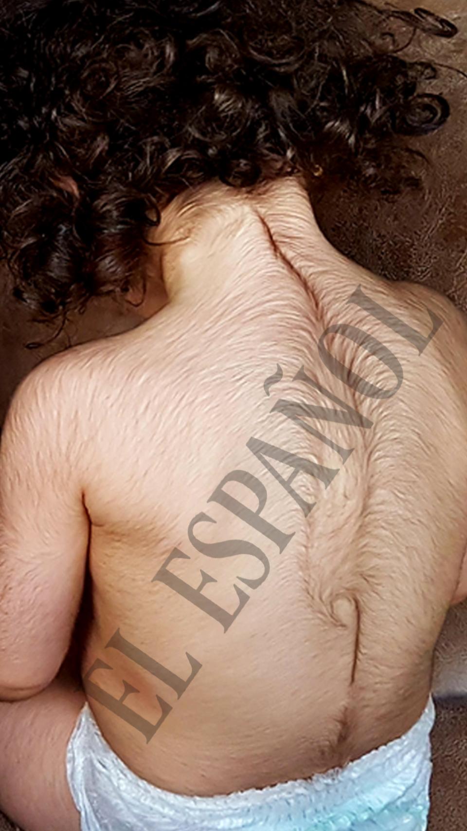 La pequeña Maite (nombre ficticio), de espaldas.