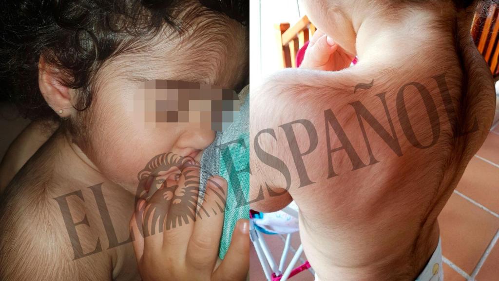 La pequeña tiene todo el cuerpo cubierto por abundante vello.