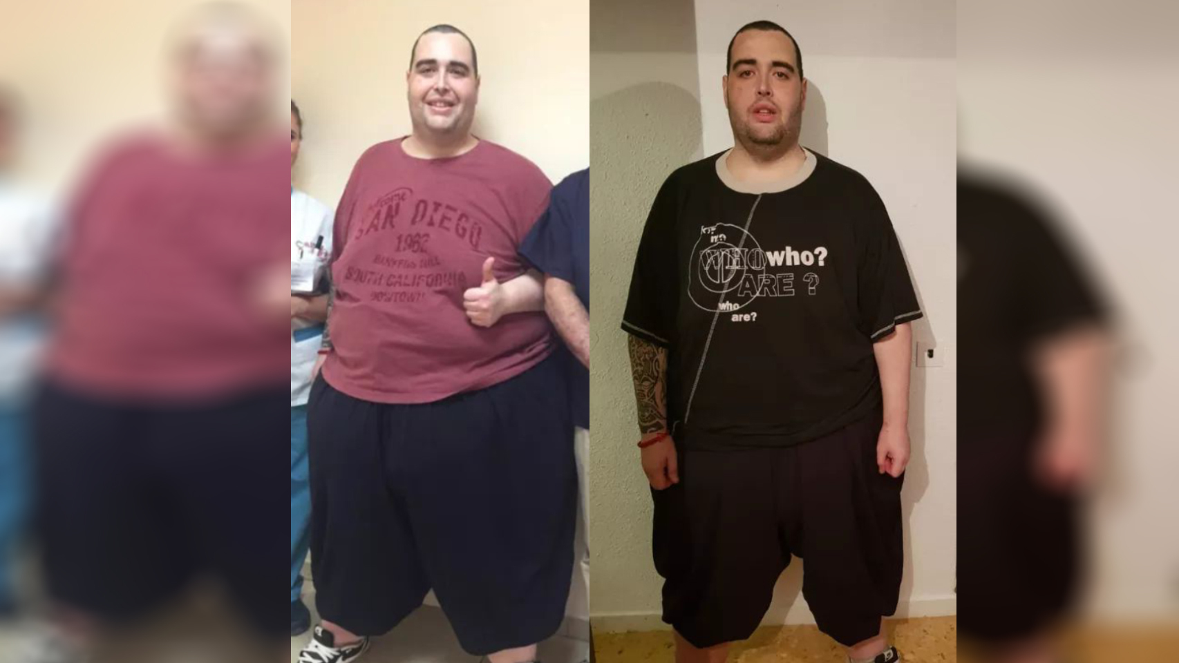 Teo antes de la operación, y en una fotografía de esta semana.