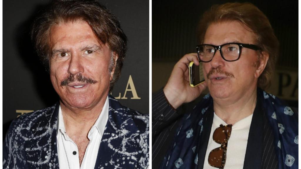 El antes y el después de Bigote Arrocet en montaje JALEOS.