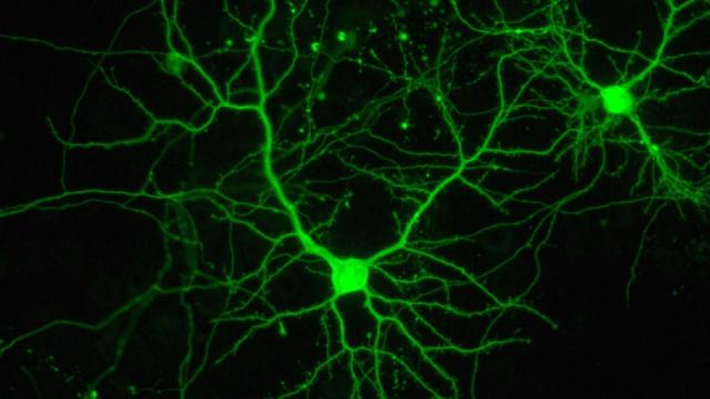 Cómo usar tecnologías fotónicas para tratar tumores, lesiones cerebrales y epilepsia