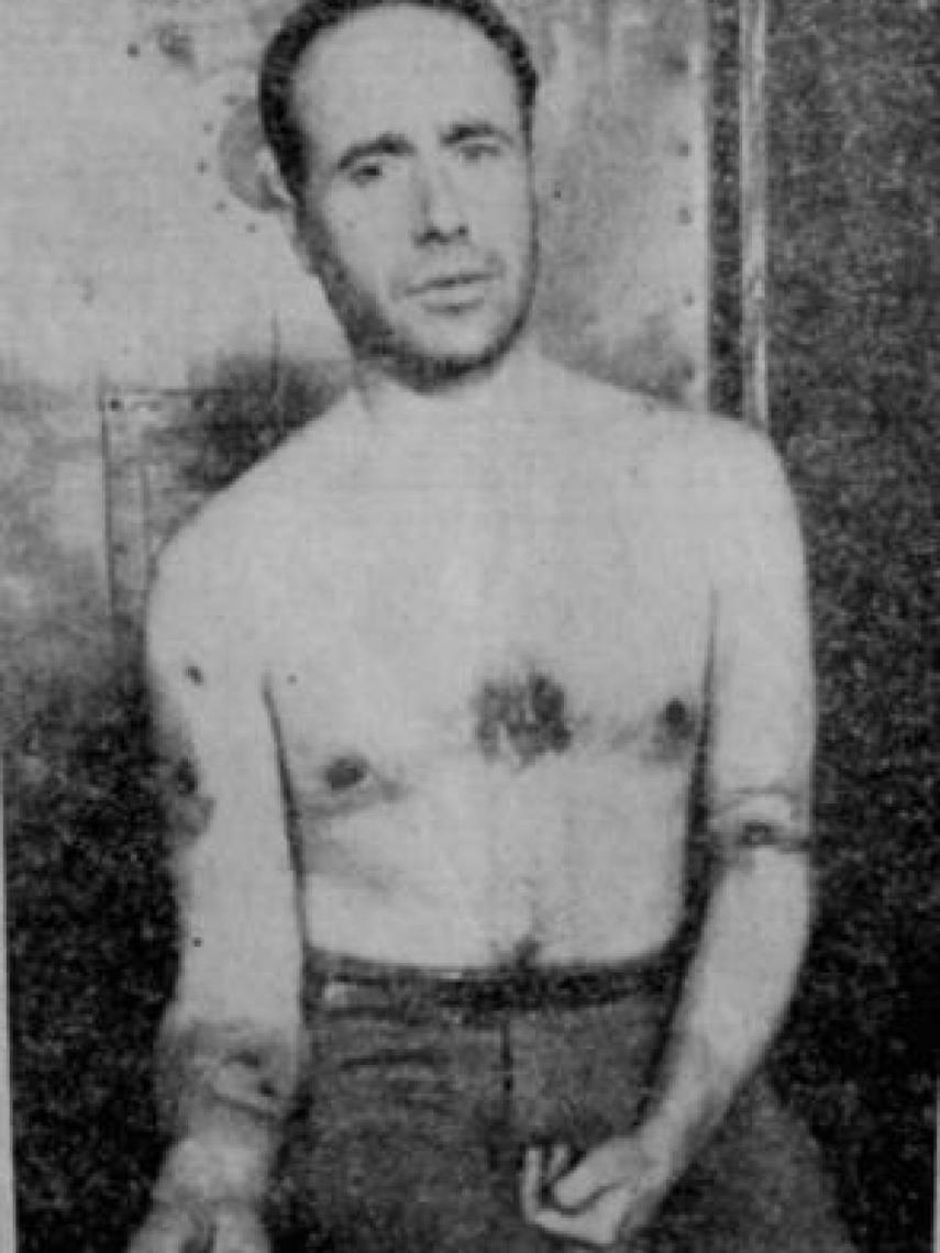 La imagen de Bueno y sus heridas.