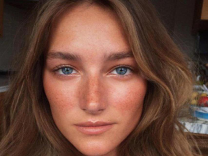 Existen varios tratamientos para luchar contra las manchas.