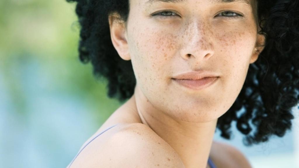 Los letingos son conocidas como 'pecas grandes'.