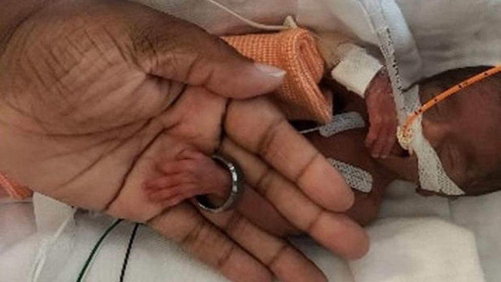 Imagen de Kallie compartida en redes sociales